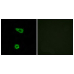 Tumor Necrosis Factor Alpha-Induced Protein 2 (TNAP2) Antibody