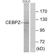 Western blot analysis of extracts from COLO cells, using C/EBP zeta antibody.