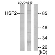 Western blot analysis of extracts from LOVO cells and A549 cells, using HSF2 antibody.