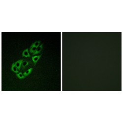 Single-Stranded DNA-Binding Protein, Mitochondrial (MtSSB) Antibody