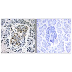 Single-Stranded DNA-Binding Protein, Mitochondrial (MtSSB) Antibody