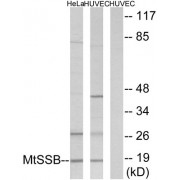 Western blot analysis of extracts from HeLa cells and HUVEC cells, using MtSSB antibody.