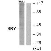 Western blot analysis of extracts from HeLa cells, using SRY antibody.