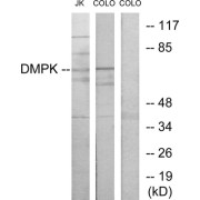 Western blot analysis of extracts from Jurkat cells and COLO205 cells, using DMPK antibody.