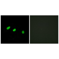 Transformer-2 Protein Homolog Alpha (TRA-2 alpha) Antibody