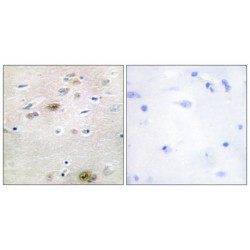 Transformer-2 Protein Homolog Alpha (TRA-2 alpha) Antibody