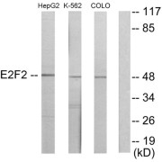 Western blot analysis of extracts from HepG2 cells, K562 cells and COLO205 cells, using E2F2 antibody.