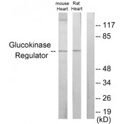 Western blot analysis of extracts from mouse heart cells and rat heart cells, using Glucokinase Regulator antibody.