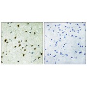 Immunohistochemistry analysis of paraffin-embedded human brain tissue, using MAD4 antibody.