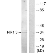 Western blot analysis of extracts from Jurkat cells, treated with serum (20%, 15mins), using NR1I3 antibody.