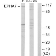 Western blot analysis of extracts from Jurkat cells and COLO205 cells, using EPHA7 antibody.