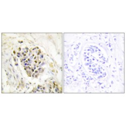 Mediator Complex Subunit 1 (MED1) Antibody