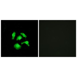 TSC22 Domain Family Protein 1 (TSC22D1) Antibody