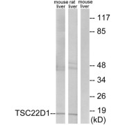 Western blot analysis of extracts from mouse liver cells and rat liver cells, using TSC22D1 antibody.