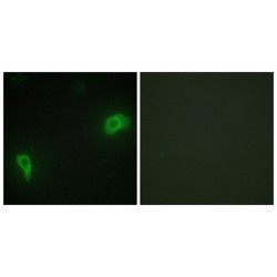 Protein Dok-7 (DOK7) Antibody