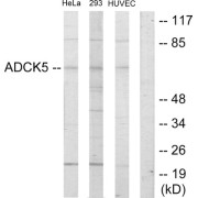 Western blot analysis of extracts from HeLa cells, 293 cells and HUVEC cells, using ADCK5 antibody.