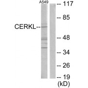 Western blot analysis of extracts from A549 cells, using CERKL antibody.