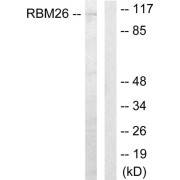 Western blot analysis of extracts from Jurkat cells, using RBM26 antibody.