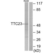 Western blot analysis of extracts from RAW264.7 cells, using TTC23 antibody.