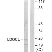 Western blot analysis of extracts from COLO205 cells, using LDOCL antibody.