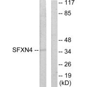 Western blot analysis of extracts from HUVEC cells, using SFXN4 antibody.