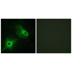 Kinase Suppressor of Ras 2 (KSR2) Antibody