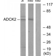 Western blot analysis of extracts from Jurkat cells and K562 cells, using ADCK2 antibody.