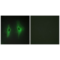 Diacylglycerol Kinase Eta (DGKH) Antibody