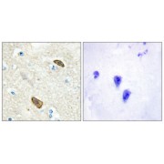 Immunohistochemical analysis of paraffin-embedded human brain tissue using PLXDC1 antibody.