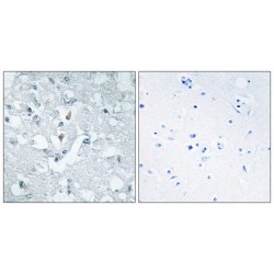 Glycerate Kinase (GLCTK) Antibody