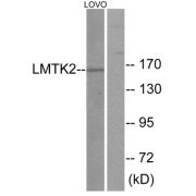 Western blot analysis of extracts from LOVO cells, using LMTK2 antibody.