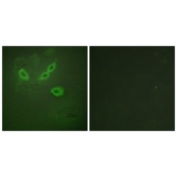 Tumor Suppressor Candidate 5 (TUSC5) Antibody