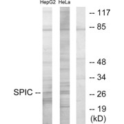 Western blot analysis of extracts from HepG2 cells and HeLa cells, using SPIC antibody.