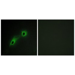 CaM Kinase-Like Vesicle-Associated Protein (CAMK5) Antibody