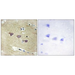 CaM Kinase-Like Vesicle-Associated Protein (CAMK5) Antibody