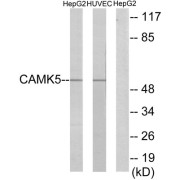 Western blot analysis of extracts from HepG2 cells and HUVEC cells, using CAMK5 antibody.