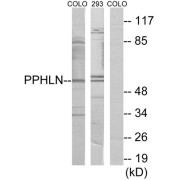 Western blot analysis of extracts from COLO cells and 293 cells, using PPHLN antibody.