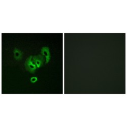 Steap Family Member 2 (STEA2) Antibody