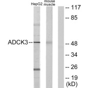 Western blot analysis of extracts from HepG2 cells and mouse muscle cells, using ADCK3 antibody.