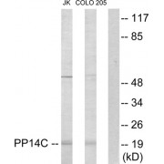 Western blot analysis of extracts from Jurkat cells and COLO205 cells, using PP14C antibody.
