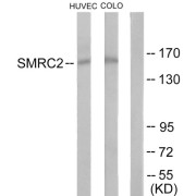 Western blot analysis of extracts from HUVEC cells and COLO205 cells, using SMRC2 antibody.