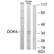 Western blot analysis of extracts from 293 cells and mouse lung cells, using DOK4 antibody.