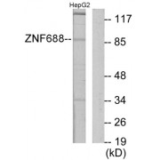 Western blot analysis of extracts from HepG2 cells, using ZNF688 antibody.