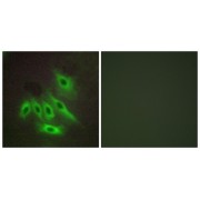 Immunofluorescence analysis of HepG2 cells, using MUC16 antibody.
