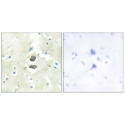 BRI3-Binding Protein (BRI3B) Antibody