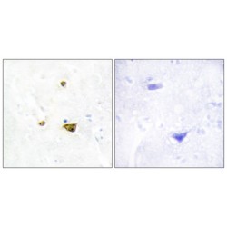 Enhancer Of Zeste Homolog 1 (EZH1) Antibody