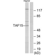 Western blot analysis of extracts from HepG2 cells, using TAF15 antibody.