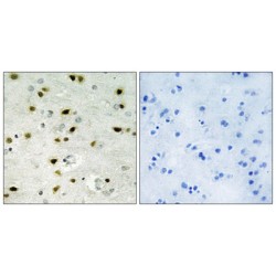 Histone H2B Antibody