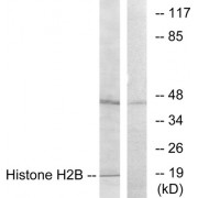 Western blot analysis of extracts from A549 cells, using Histone H2B antibody.