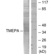 Western blot analysis of extracts from HT-29 cells, using TMEPA antibody.